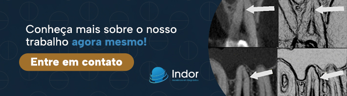 endodontia em foco