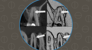 endodontia inteligente