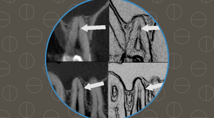 endodontia inteligente